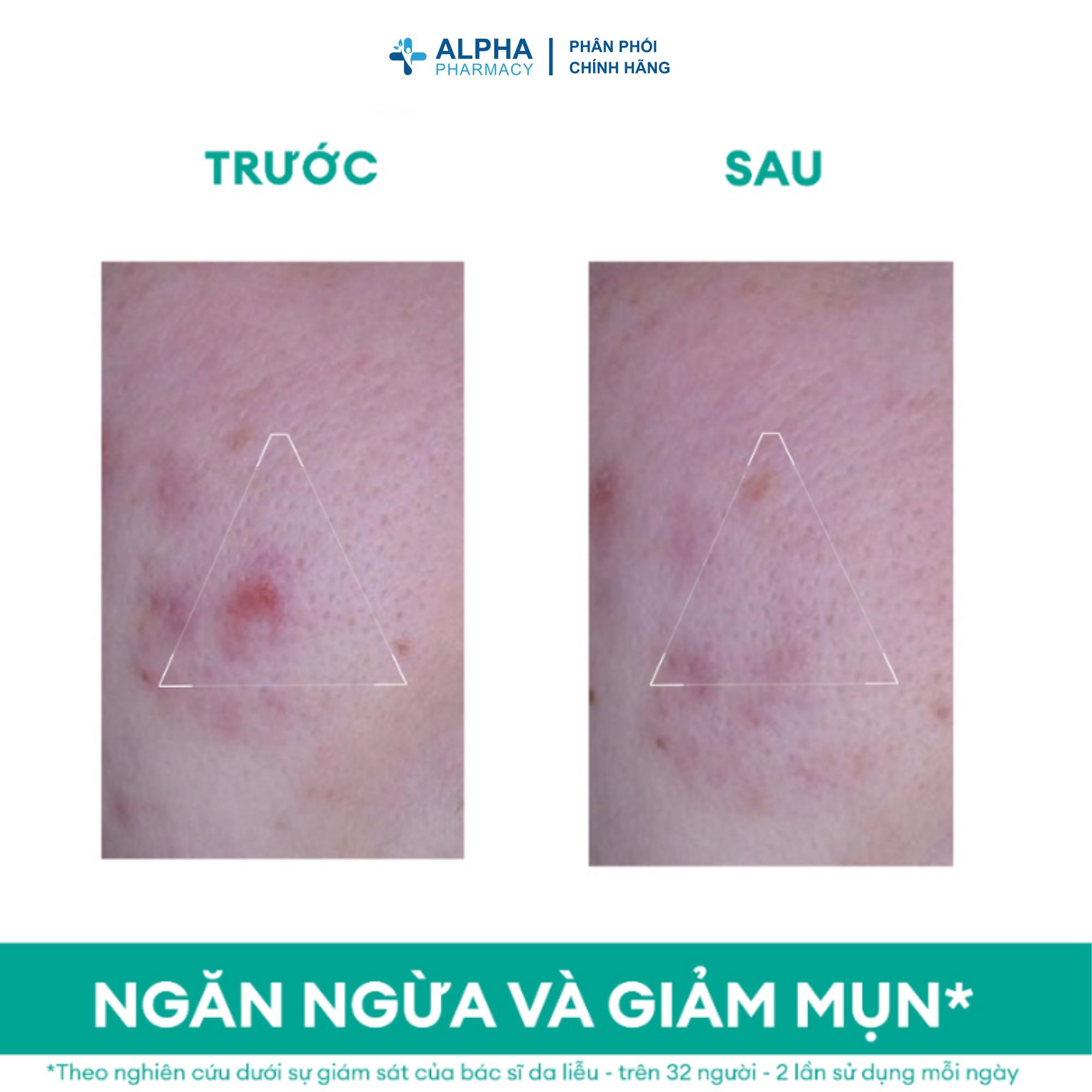 Kem Dưỡng Uriage Hyseac 3-Regul+ Anti Imperfections Giảm Mụn Kháng Khuẩn & Kiểm Soát Nhờn – 40ml - Image 2