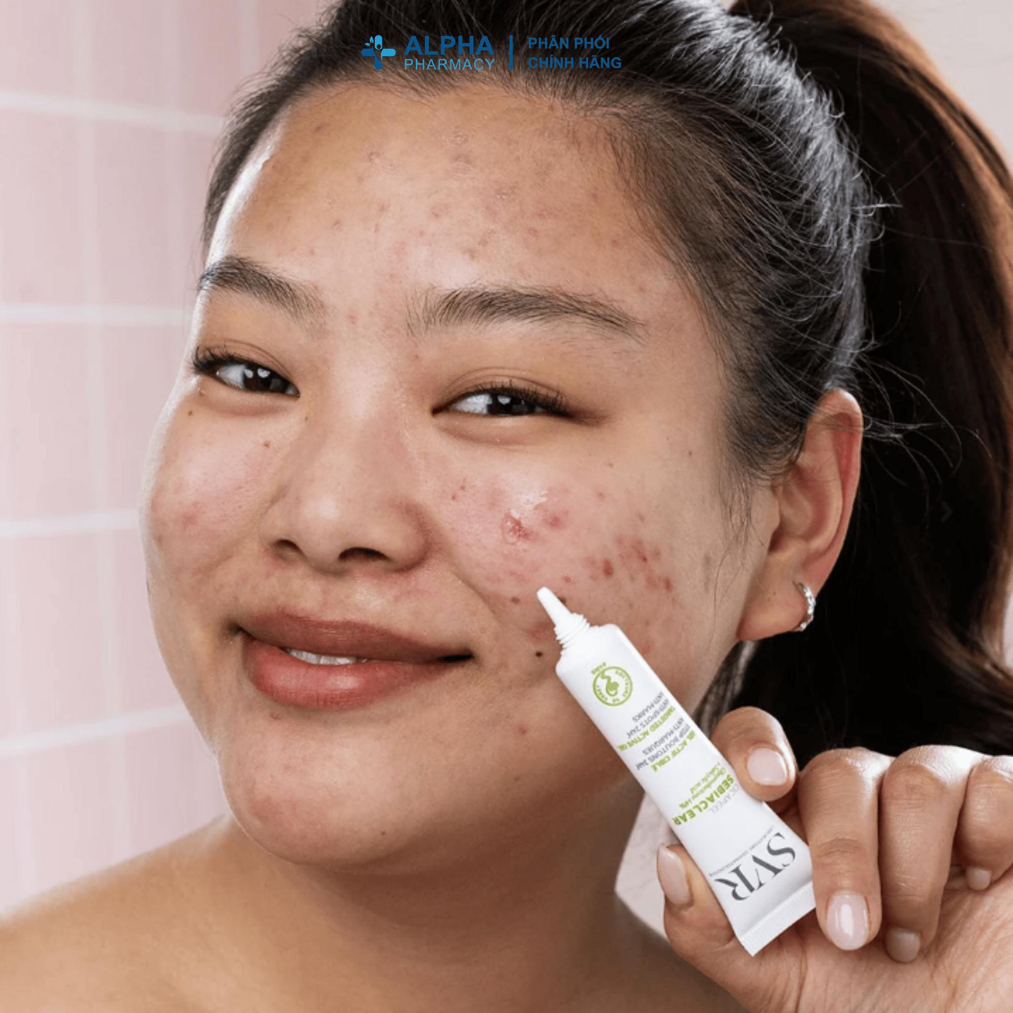 Kem Chấm Mụn SVR Sebiaclear Cicapeel Dạng Gel Giảm Sưng & Làm Khô Mụn – 15ml - Image 5