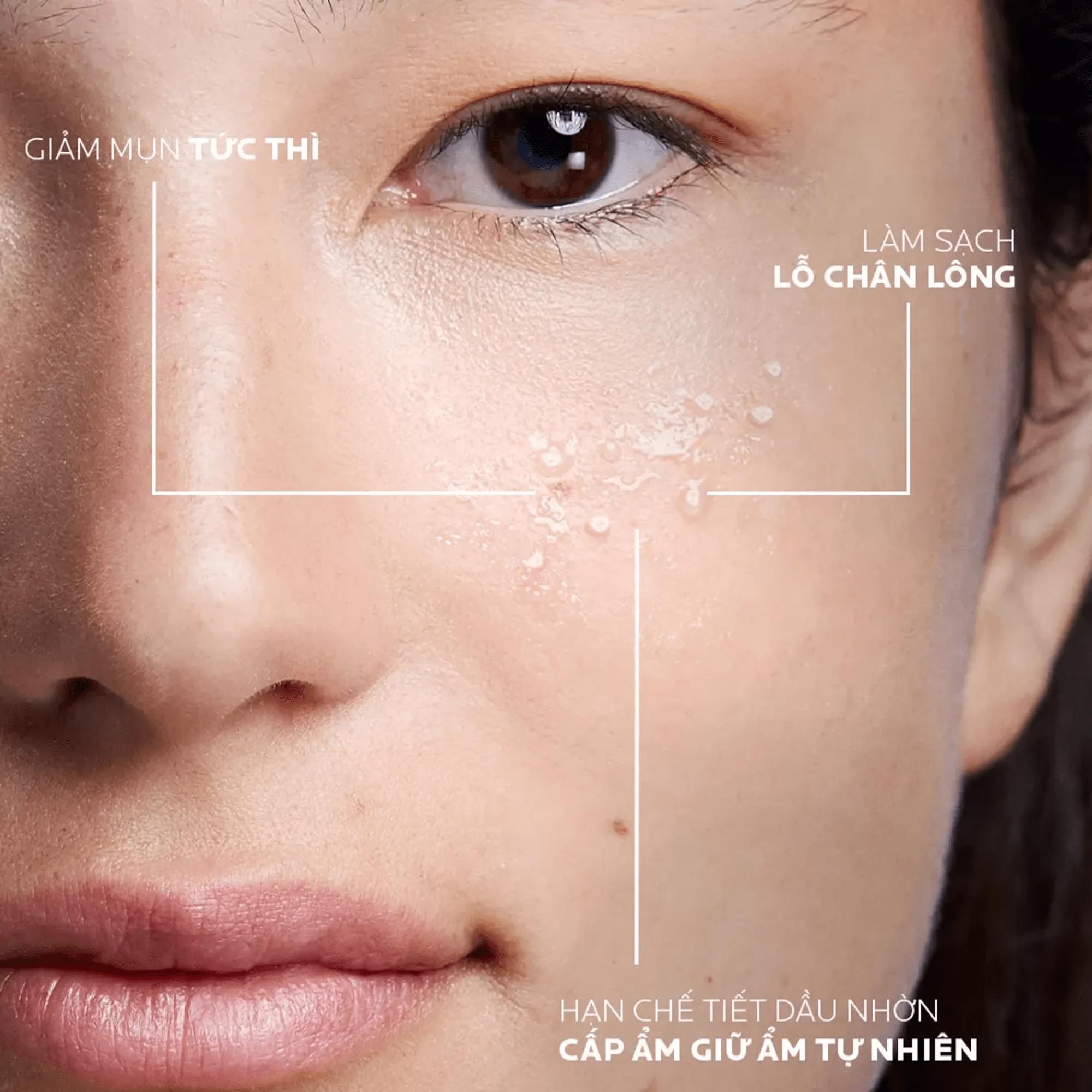 Nước Cân Bằng La Roche-Posay Effaclar Astringent Lotion Giàu Khoáng Cho Da Dầu Mụn – 200ml - Image 5