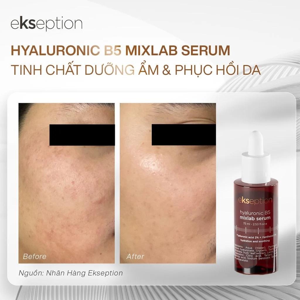 Tinh Chất Dưỡng Ẩm Và Làm Dịu Da Ekseption Hyaluronic B5 Mixlab - 75ml - Image 4