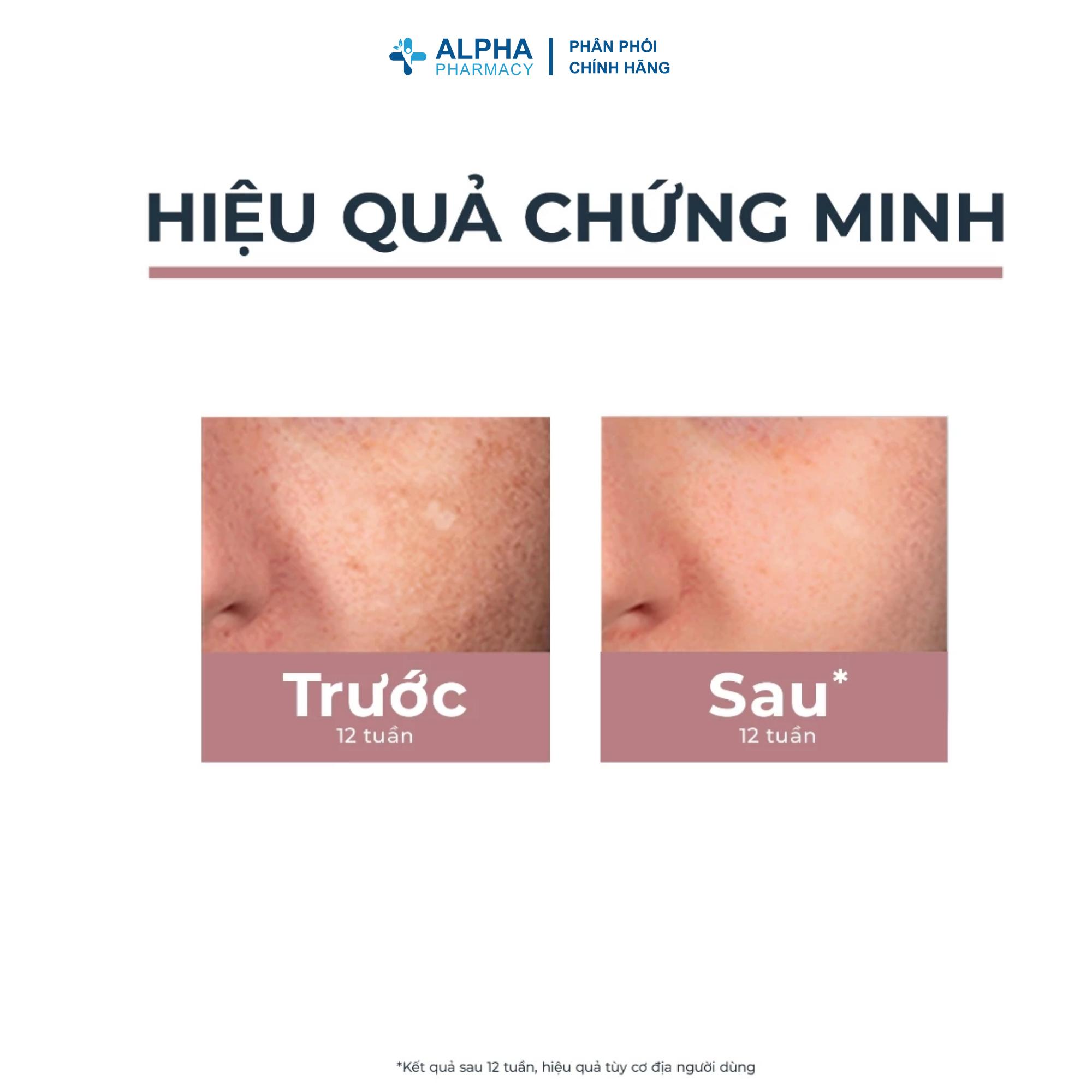 Bút Chấm Mờ Đốm Nâu Eucerin Spotless Giúp Làm Sáng Da, Giảm Thâm Nám - 5ml - Image 3