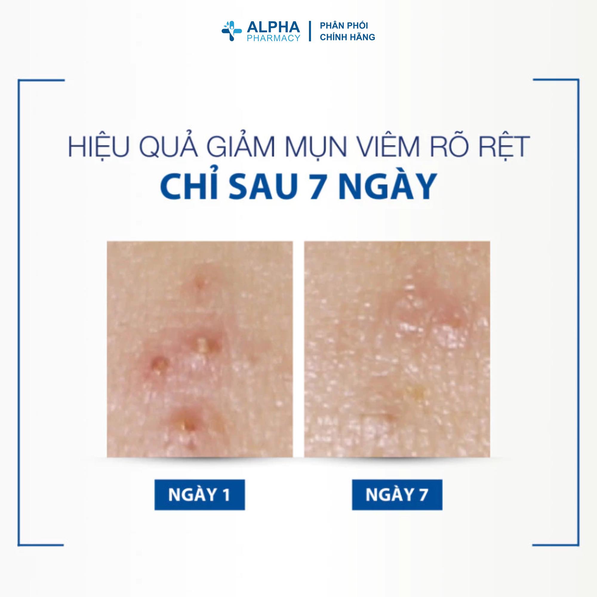 Kem Dưỡng Ducray Keracnyl PP+ Anti - Blemish Giúp Giảm Mụn Viêm, Mờ Vết Thâm - 30ml - Image 6